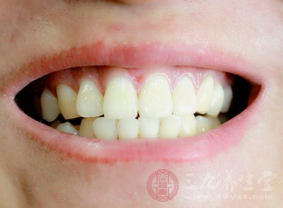 洗牙可以美白牙齿