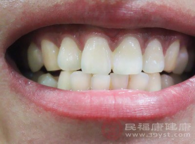 牙龈炎的治疗方法 治疗牙龈炎有这些偏方(2)