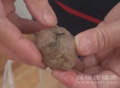 廖女士掰开一看,发现里面有一大撮毛。廖女士告诉记者,最后自己把这一锅肉丸汤都给倒掉了 廖女士掰开一看,发现里面有一大撮毛。廖女士告诉记者,最后自己把这一锅肉丸汤都给倒掉了