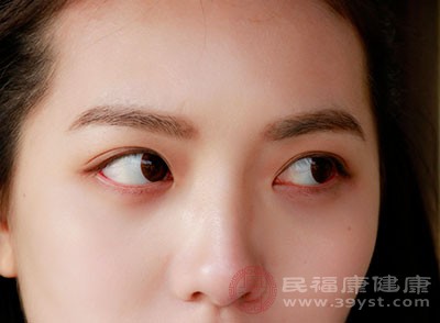 眼部清洁一定要做干净、彻底，以免皮肤长期残留化妆品造成黑眼圈