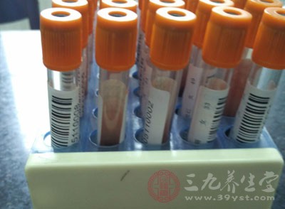 白血球正常值 人体白血球的数值范围(2)