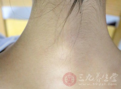 这里仅介绍一种可引起腿痛的脊髓型颈椎病