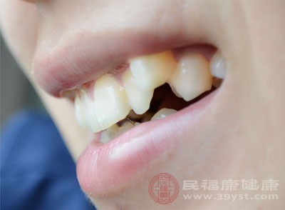 定期的到医院洗牙可预防一些口腔的疾病