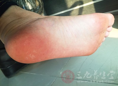 古人有每日搓脚心百次的养生法 古人有每日搓脚心百次的养生法
