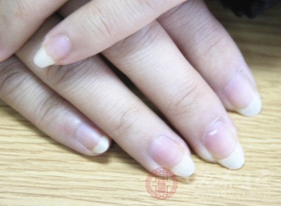 而体寒的女性,指甲上的月牙儿就少 而体寒的女性,指甲上的月牙儿就少