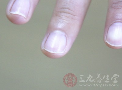 因为指甲上有白点很肯能是重大疾病的前兆 因为指甲上有白点很肯能是重大疾病的前兆