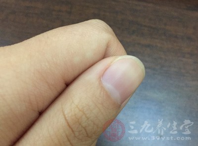 年龄影响指甲生长 年龄影响指甲生长