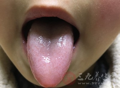 尽量少刷舌苔减少对舌乳头的刺激