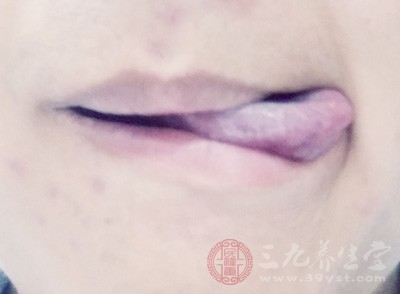 老年人味蕾退化则味觉功能减弱 老年人味蕾退化则味觉功能减弱