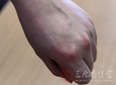 老年皮肤瘙痒症在我国老年人口中患病率达10%以上 老年皮肤瘙痒症在我国老年人口中患病率达10%以上