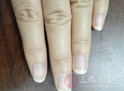 灰指甲用什么药最有效 如何治疗灰指甲(2)