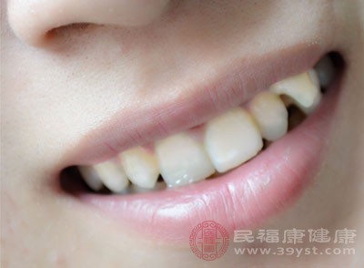 牙齿矫正完后要注意保护牙齿
