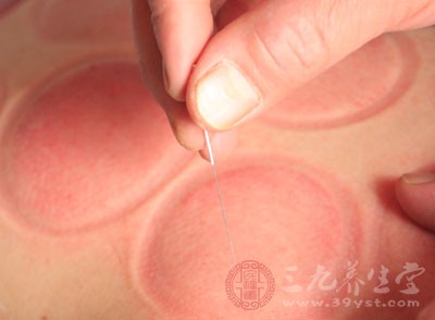 将合作开展中医针灸教育培训、学术交流、病例登记注册等