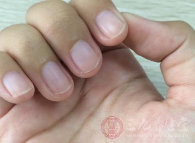 指甲出現這些裂紋證明你的身體出現了問題