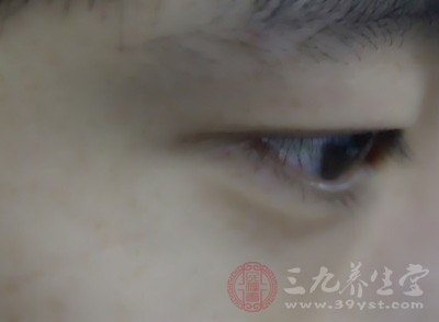 你有没有黑眼圈呢 你有没有黑眼圈呢