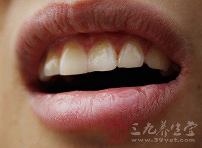 火势:头晕、耳鸣耳聋、牙齿松动或疼痛,傍晚口干 火势:头晕、耳鸣耳聋、牙齿松动或疼痛,傍晚口干