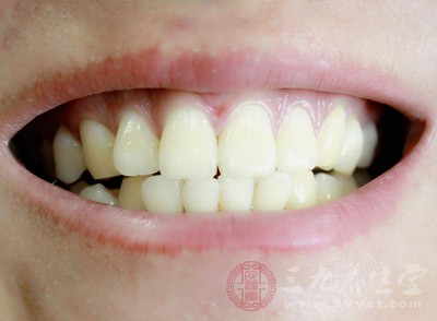 钢丝牙套多少钱 牙套要戴多久(2)