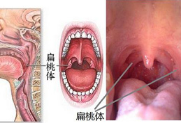 正常人的喉咙图片清晰