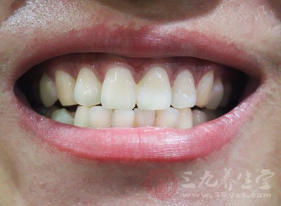 牙结石怎么去除 牙结石的危害有哪些