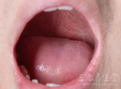 口腔癌的常见症状有哪些 口腔癌能治好吗