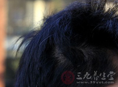 防治毛发脱落、须发早白的气功疗法 防治毛发脱落、须发早白的气功疗法