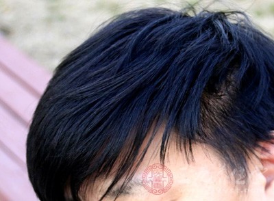 畏寒喜暖、小便清长或不利