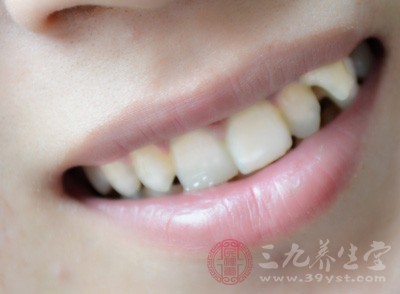 什么是氟斑牙 氟斑牙如何美白既快又有效果