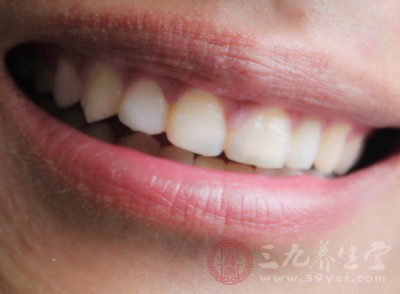 什么是氟斑牙 氟斑牙如何美白既快又有效果(2