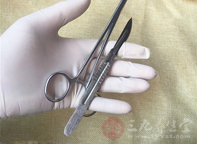 什么是宫颈原位癌 宫颈原位癌有哪些早期症状