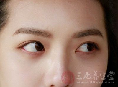 韩式三点双眼皮恢复时间多长 这些事项要注意