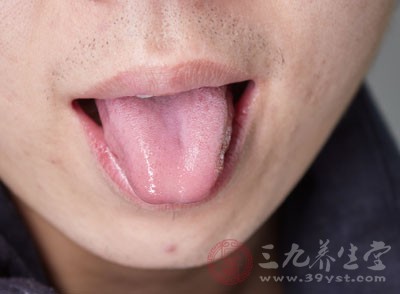 青紫舌一定就是癌症吗 舌头出现这些要注意(2