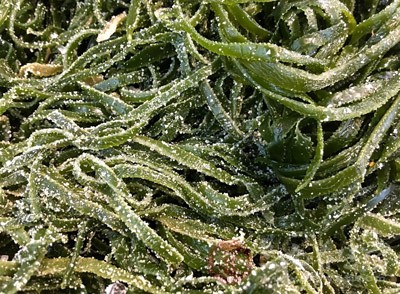 食用海带、萝卜、豆腐、洋葱会好一点 食用海带、萝卜、豆腐、洋葱会好一点