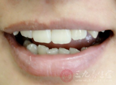 牙龈出血怎么办 这样做竟会导致牙龈出血