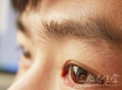 青光眼是怎么引起的 这五种方法可预防