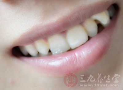 牙龈出血是什么原因 牙龈出血可能是因为这个