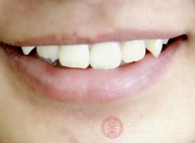牙周炎怎么治疗 四种方法还你健康牙齿