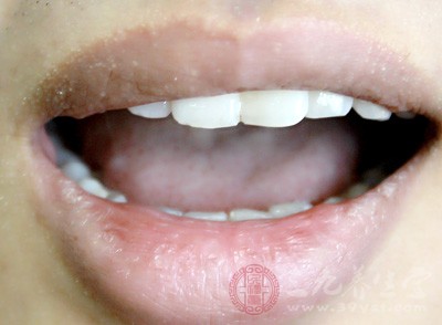 怎样美白牙齿 五种方法还你炫丽牙齿