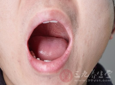 舌头发白是怎么回事 三大因素导致舌头发白