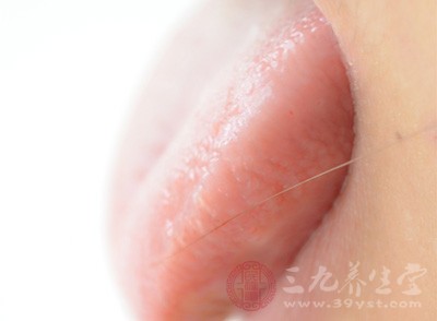 舌苔厚黄是怎么回事 舌苔厚黄的治疗方法有哪些