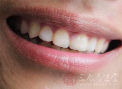 牙结石形成原因 牙结石有哪些显著的症状