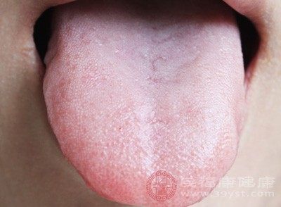 舌头发白是什么原因 舌头发白可以吃它们