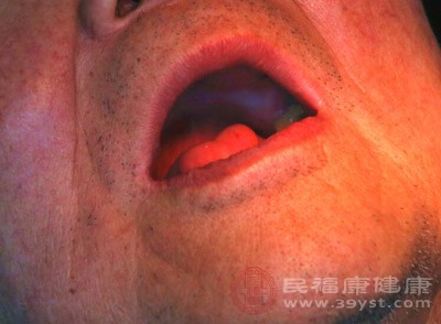 口腔筒照射治疗主要适用于病灶浅、易于暴露