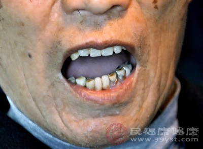 牙龈萎缩后不能再像从前一样紧紧包裹牙根
