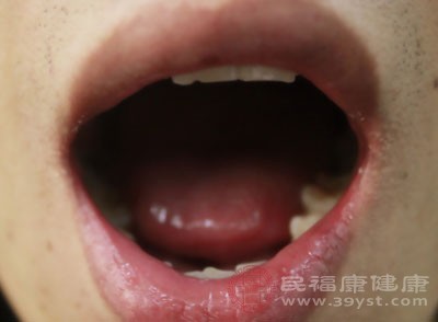 肾阴虚舌头的表现 舌头4种表现说明肾阴虚