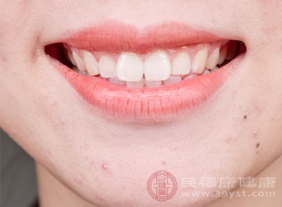 牙齿美白 四个小技巧让你牙齿洁白笑容亮眼