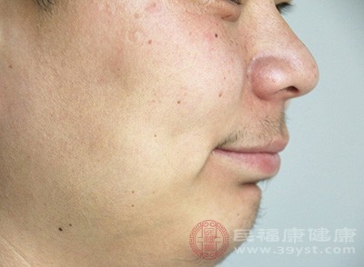 激光脱毛有色素变化的隐患