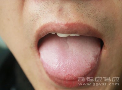 舌苔发白时饮食应以清淡易消化为主