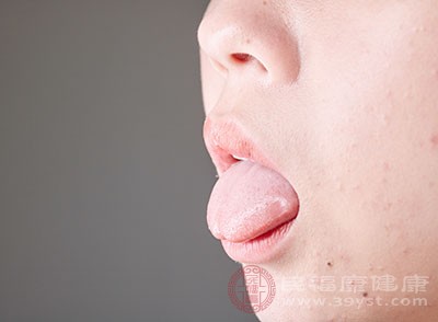 舌苔发白是什么原因