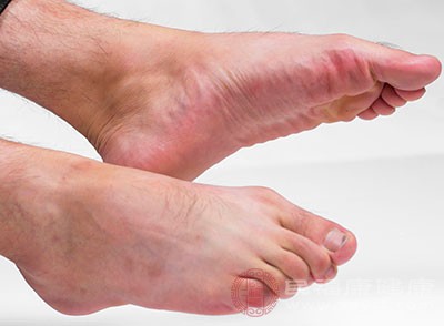 有患者因久患脚气不治，导致丹毒出现