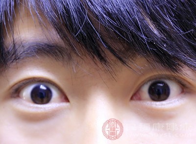 结膜炎的患者日常要做好眼睛的护理
